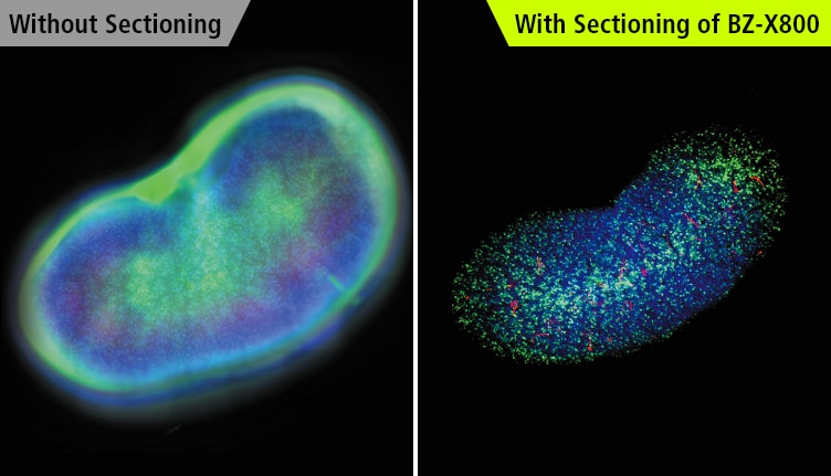 Without Sectioning / With Sectioning of BZ-X800