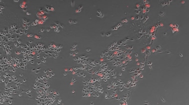 Zählung von Zellen anhand eines Phasenkontrastbildes