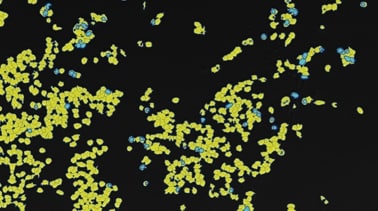 Zählung von Expressionsereignissen (fluoreszierende Punkte) anhand von Zellen im Auswahlbereich